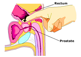 prostate massage prostate massage