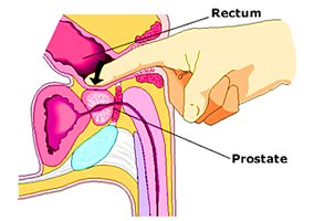 prostate massage prostate massage