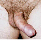 a bent penis can cause vaginismus