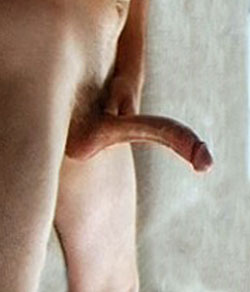 A bent penis caused by masturbation