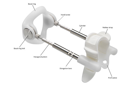 peyronies treatment using penis traction