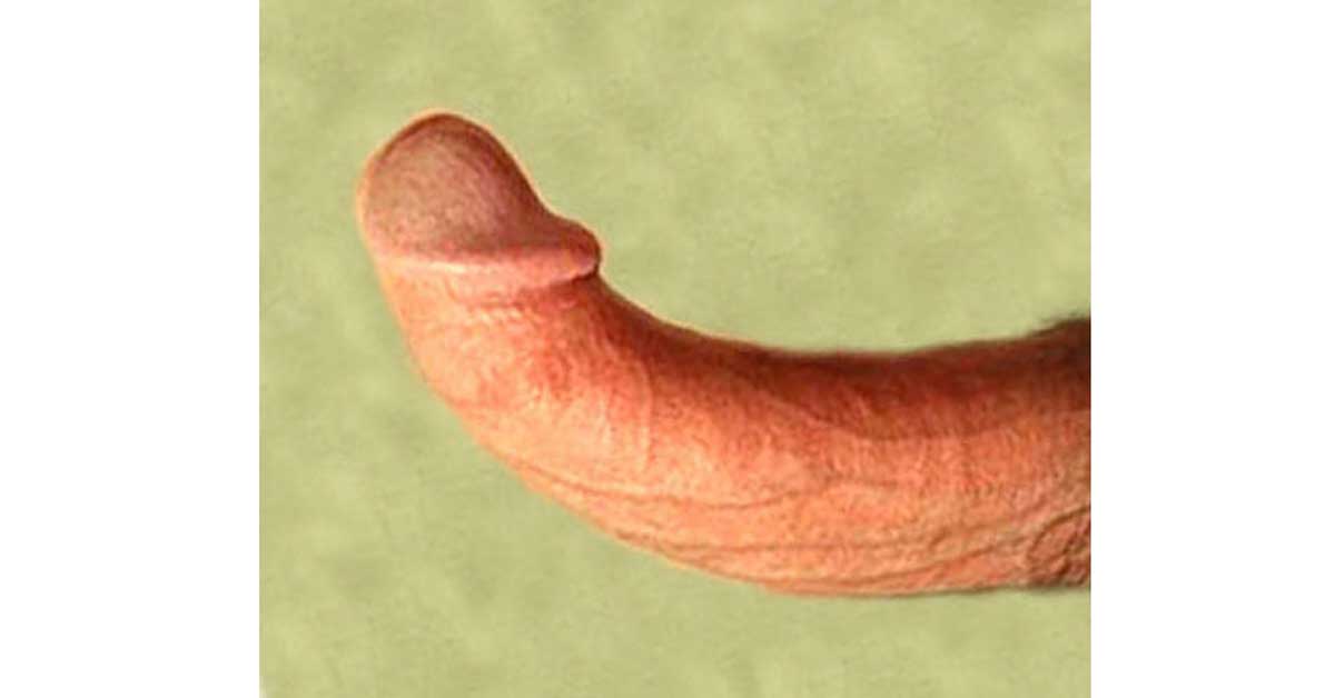 upward curved penis