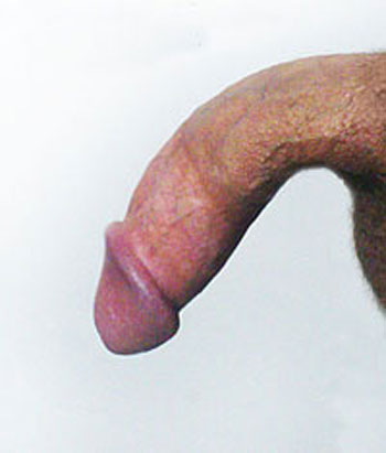 curved down penis