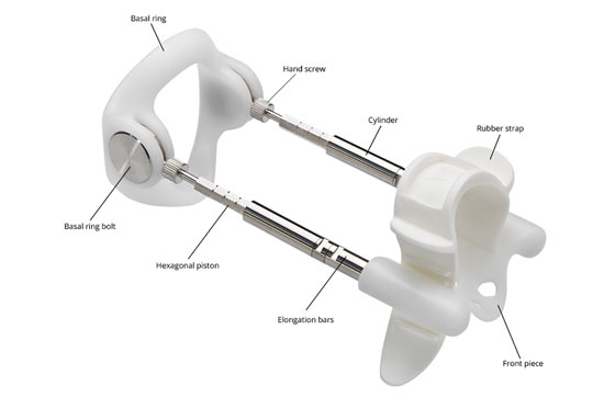 penis traction device for peyronies disease straightening