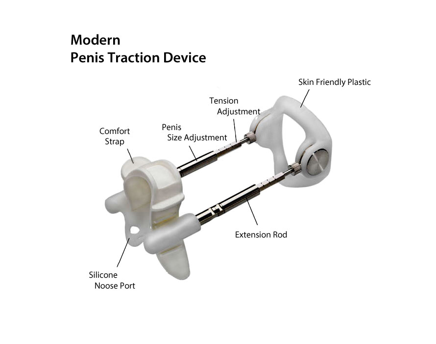 Correct Penis Traction is the safest medically endorsed and recommended treatment for Peyronies Disease.